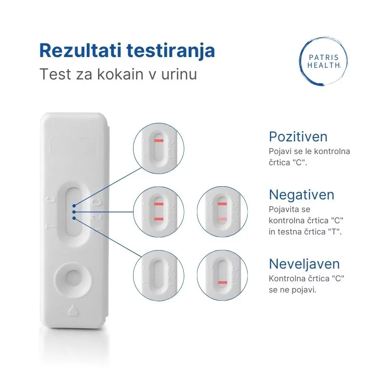 Odčitavanje rezultatov testiranja na kokain
